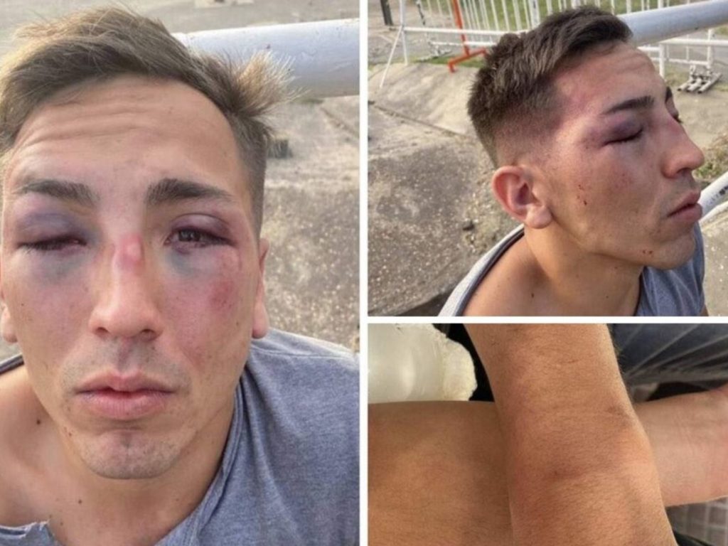 David mostró su rostro golpeado por los patovicas de Mandarine Park.